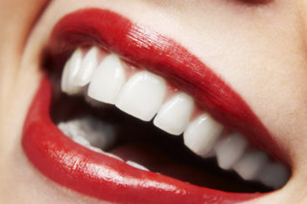 Afbeelding cosmetische tandheelkunde