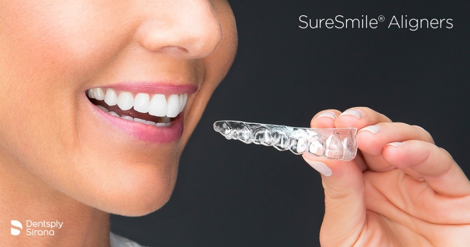 foto van een suresmile onzichtbare beugel